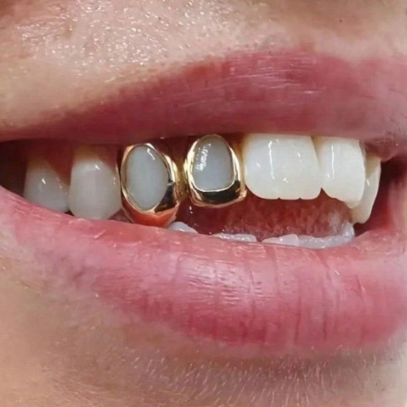 Set Perhiasan Gigi Golden Gril - Body Jewelry Lot ulasan dan harga